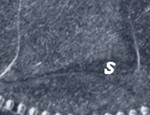S Initial